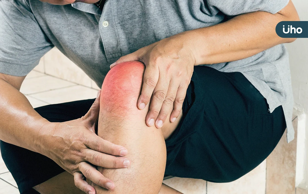 膝腫痛以為退化性關節炎？檢查竟是「骨結核病變」！醫：膝蓋痛別拖