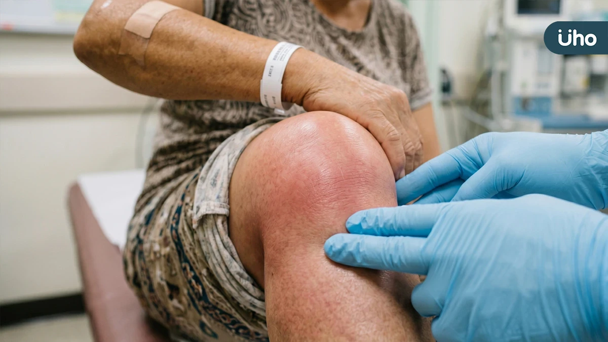 關節不只會退化，「骨頭中風」只吃止痛藥恐加劇磨損：高血糖、高血脂突然劇痛要當心