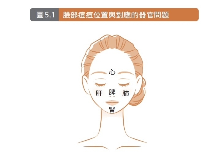 臉上痘痘位置