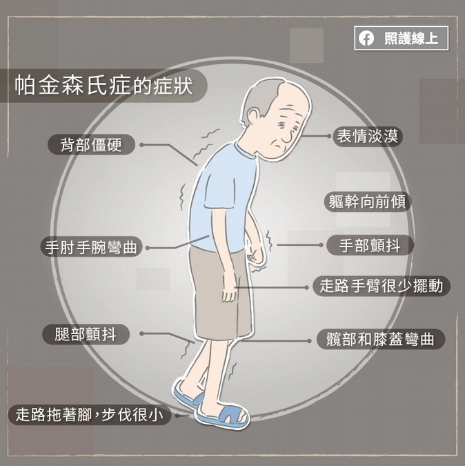 巴金森氏症會進展的很快嗎?