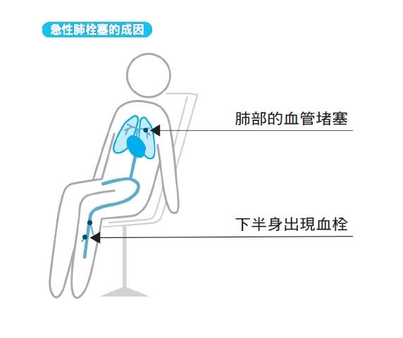 每30分鐘站起來一次,並補充水分