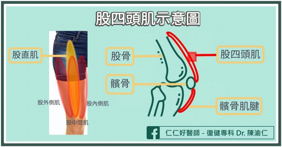 為什麼股四頭肌會撕裂?