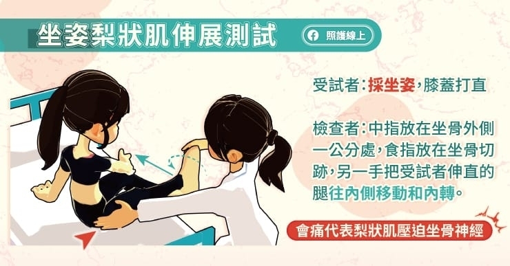 深臀症候群的幾種病狀