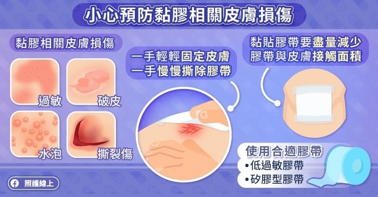 小心預防黏膠相關皮膚損傷