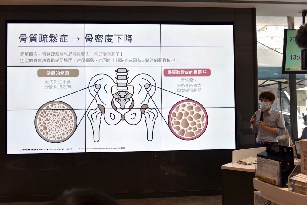 有肌少症徵兆　加強蛋白質補充