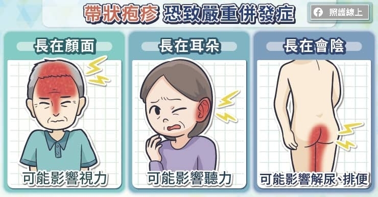 損壞視力、聽力,帶狀疱疹恐致嚴重併發症