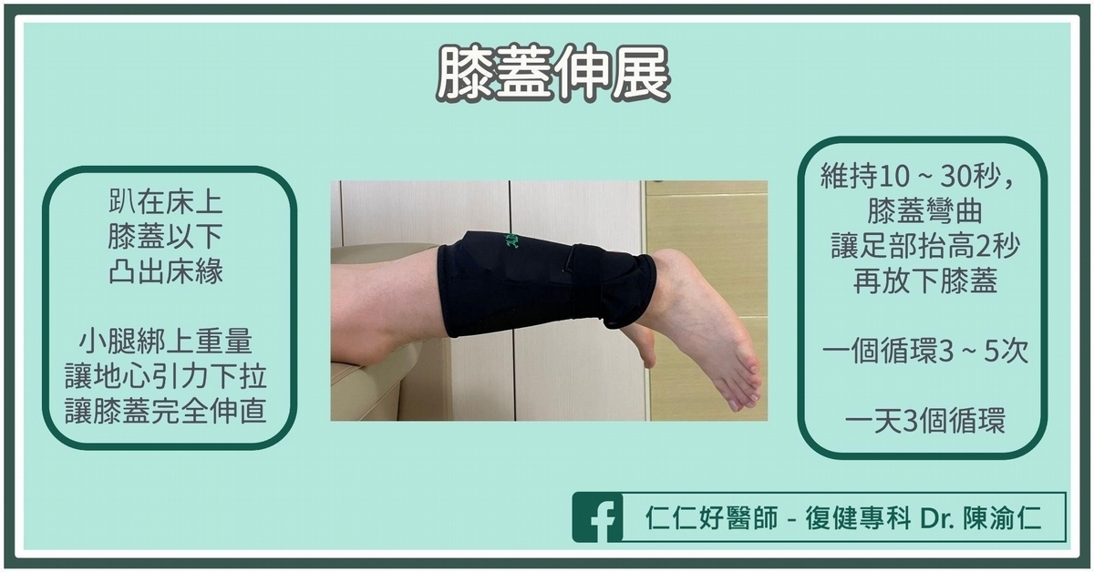 膝內側副韌帶的復健運動怎麼做?