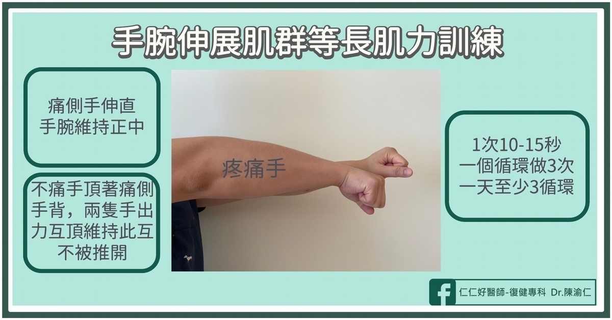 擰毛巾沒力、手肘腫痛⋯沒打網球也會得「網球肘」？醫教1動作判斷