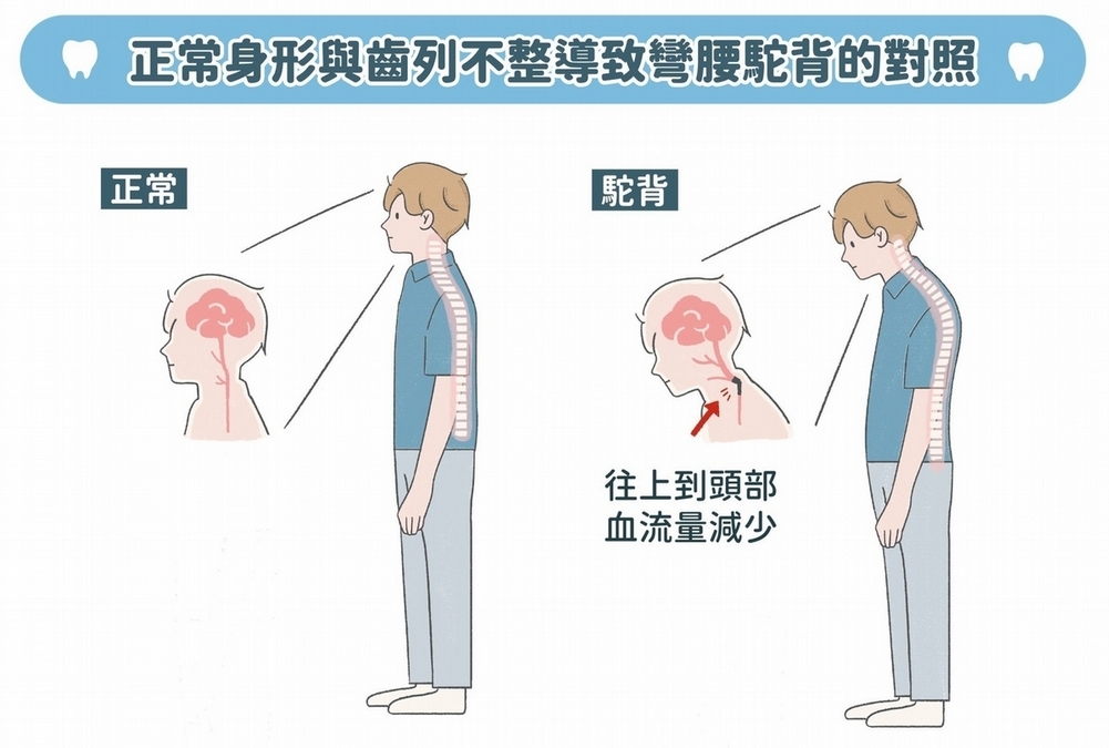 高低肩、駝背竟跟牙齒有關？我家小孩要口腔矯正嗎？醫揭3評估方式