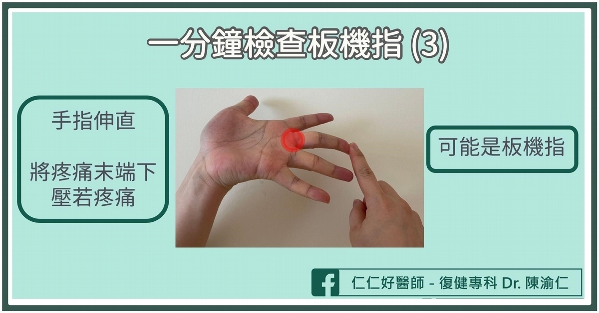 板機指疼痛伸不直⋯竟因手指操過頭！醫教「手指肌腱炎」1分鐘自測