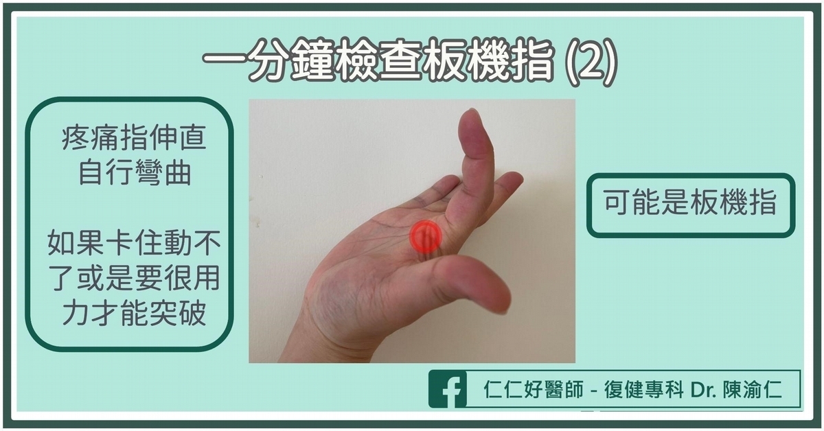 板機指疼痛伸不直⋯竟因手指操過頭！醫教「手指肌腱炎」1分鐘自測