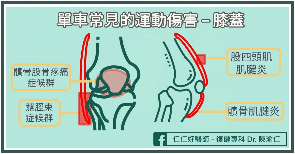 單車運動傷害1：膝蓋