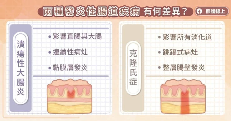 發炎性腸道疾病是什麼？