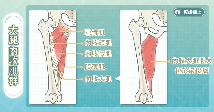 有圖解》如何訓練大腿內側肌肉？教你「壯腿4招」還能預防膝蓋受傷