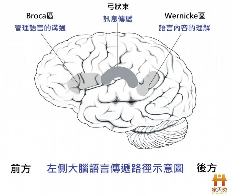 失語症是什麼？