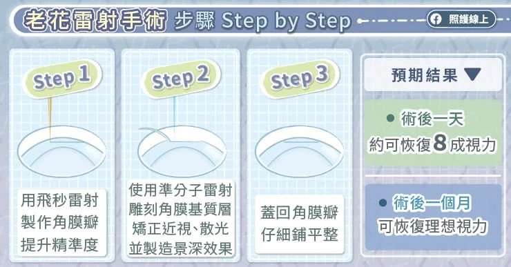 做過近視雷射，還能做老花雷射嗎？眼科醫解答：確認「這點」就可以