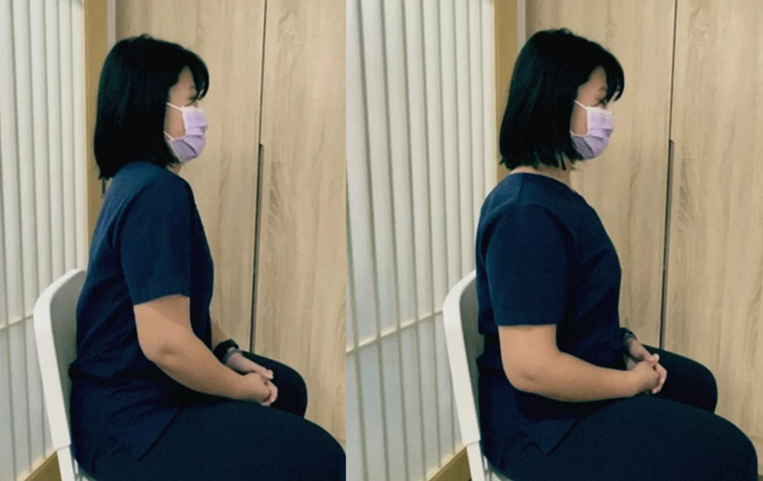 隆乳後疼痛怎麼辦？隆乳後可以運動嗎？醫教你「拉伸3招」有效舒緩