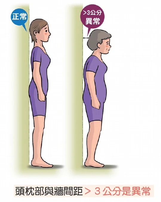 有圖解》怎麼知道自己有骨質疏鬆？醫列「居家檢測4招」免照X光