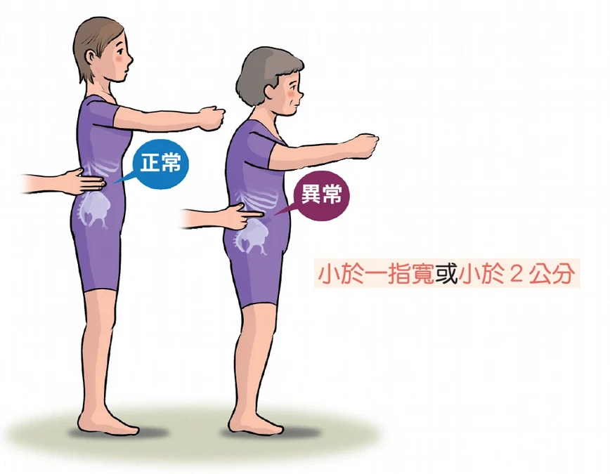 有圖解》怎麼知道自己有骨質疏鬆？醫列「居家檢測4招」免照X光