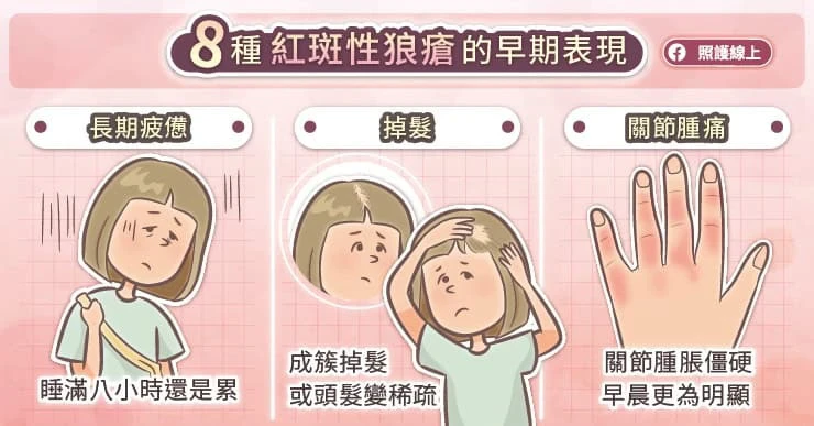 「紅斑性狼瘡」好發年輕女性！帶你揪出「8大警訊」從頭到腳都難逃