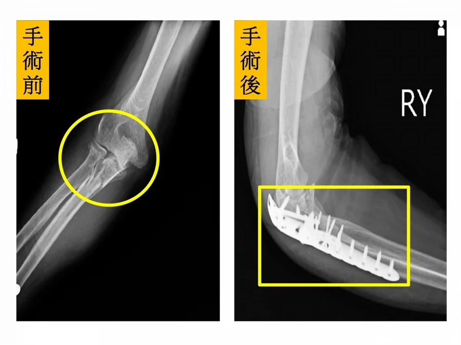 首圖
