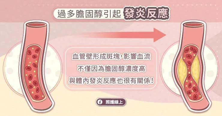 過多膽固醇引起發炎反應