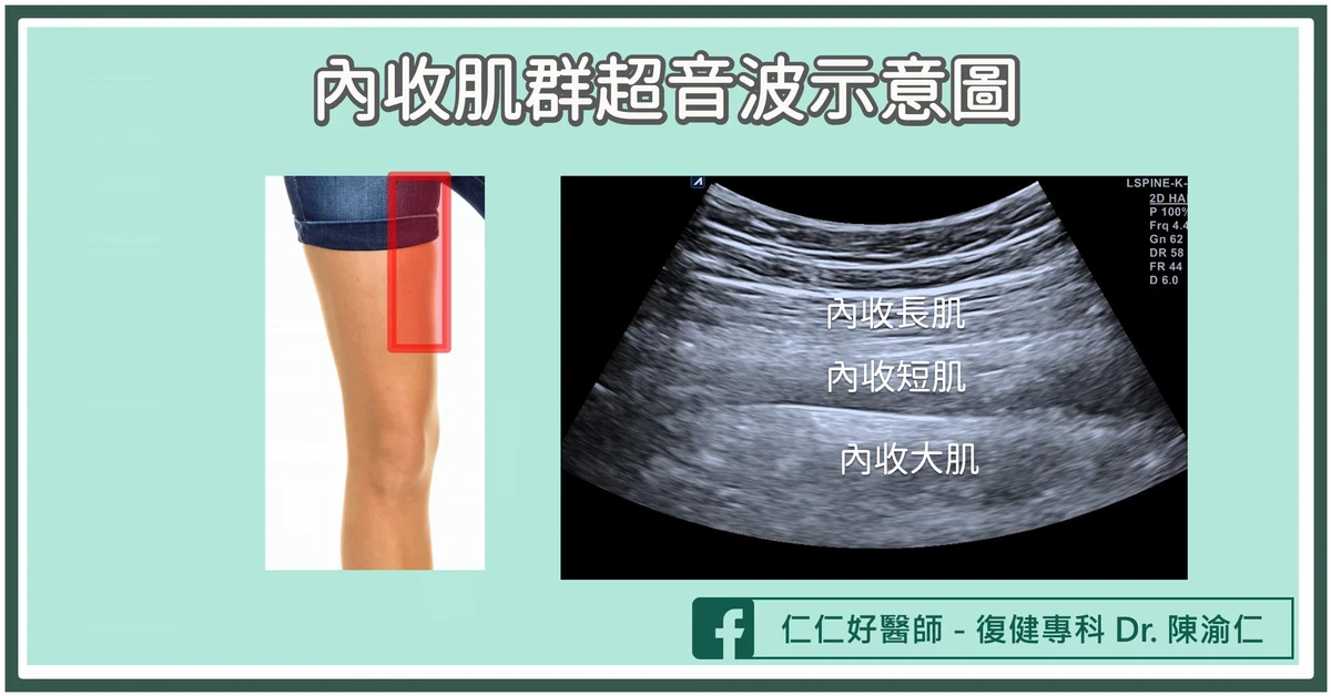 內收肌群受傷怎麼辦?