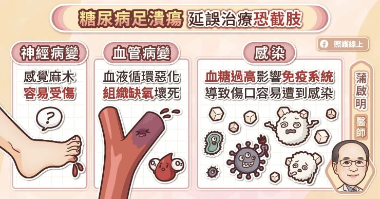 為什麼會糖尿病足潰瘍？醫示警「4大狀況」要小心：亂剪指甲也上榜