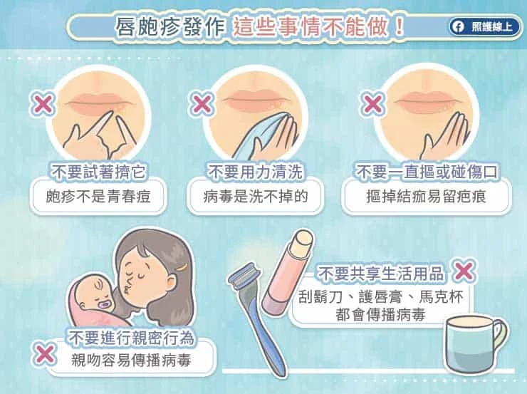 唇皰疹發作別做5件事