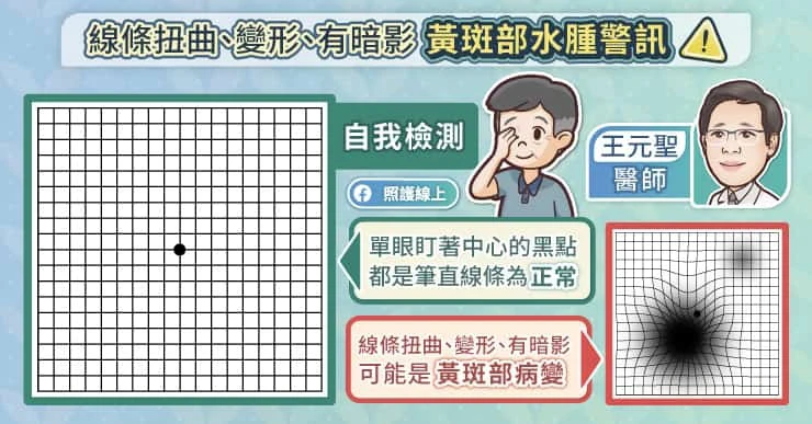 自我檢測黃斑部病變