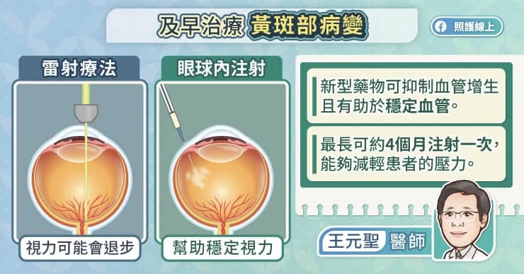 眼球內注射穩定視力