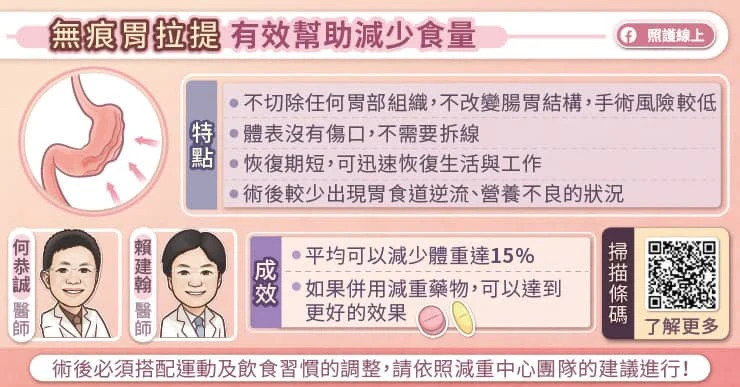 無痕胃拉提有效減少食量