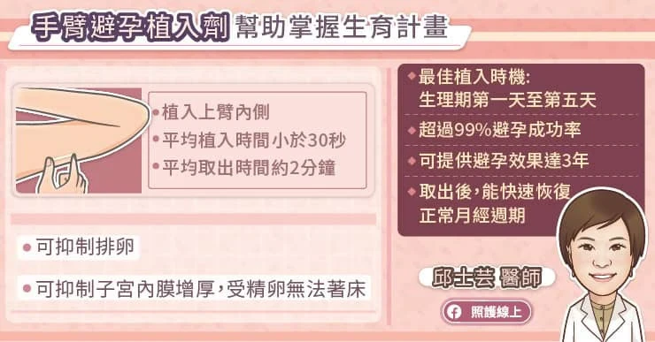 手臂避孕植入劑成功率高