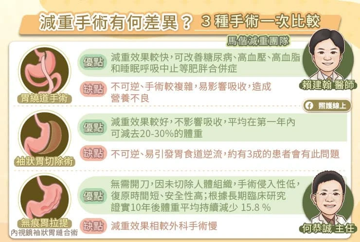 3種減重手術比較