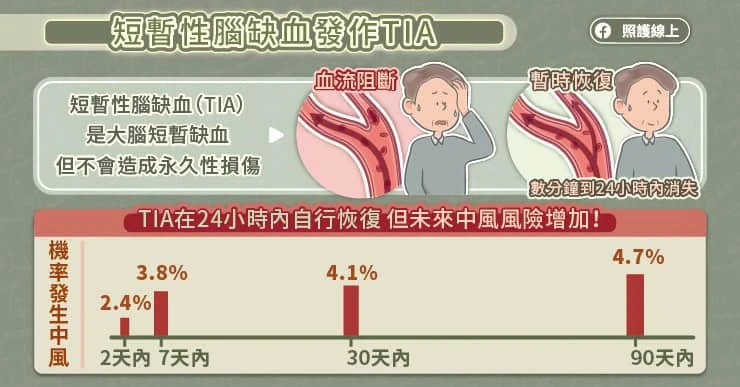 短暫性腦缺血造成「小中風」