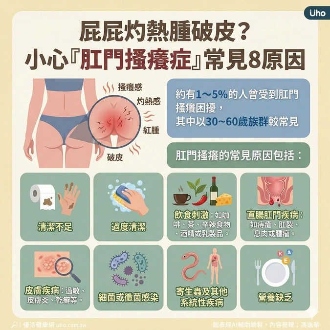 肛門搔癢症常見8種原因