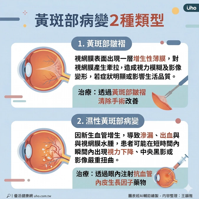 黃斑部病變2種類型
