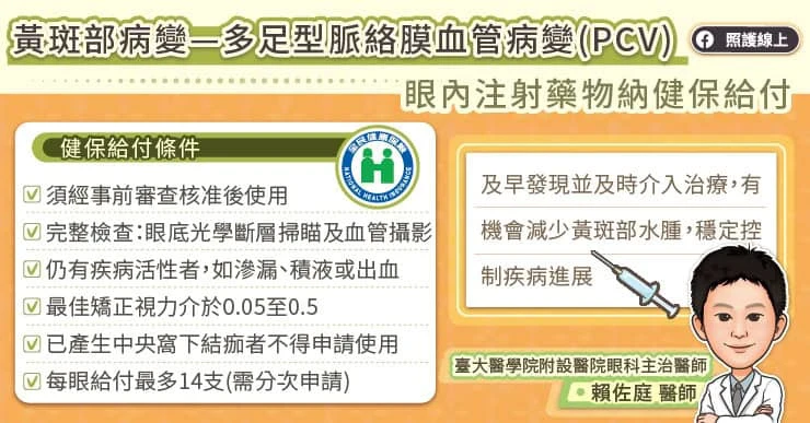 多足型脈絡膜血管病變如何治療?