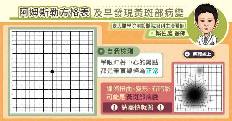如何及早發現黃斑部病變?