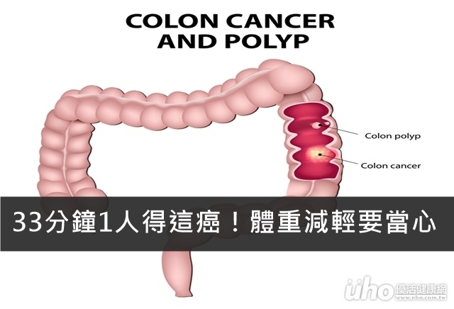 33分鐘1人得這癌！體重減輕要當心