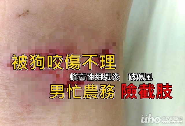 被狗咬傷不理　男忙農務險截肢！