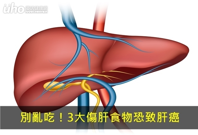 別亂吃！3大傷肝食物恐致肝癌