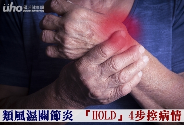 類風濕關節炎　「HOLD」4步控病情