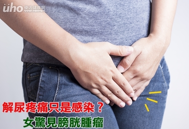 解尿疼痛只是感染？女驚見膀胱腫瘤