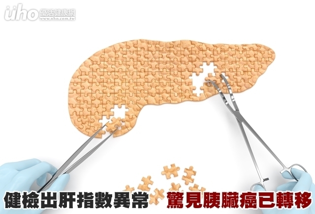 健檢出肝指數異常　驚見胰臟癌已轉移