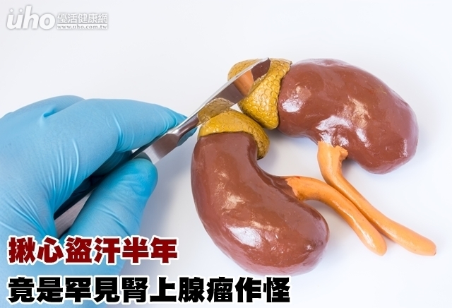 揪心盜汗半年　竟是罕見腎上腺瘤作怪