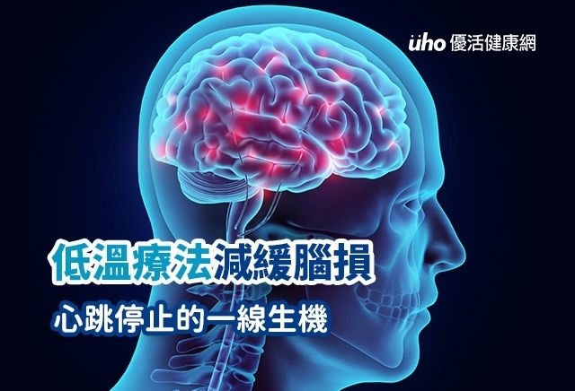 低溫療法減緩腦損　心跳停止的一線生機