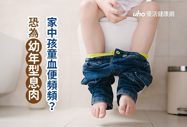 家中孩童血便頻頻？　恐為幼年型息肉