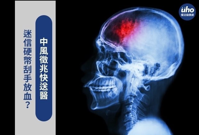 迷信硬幣刮手放血？中風徵兆快送醫