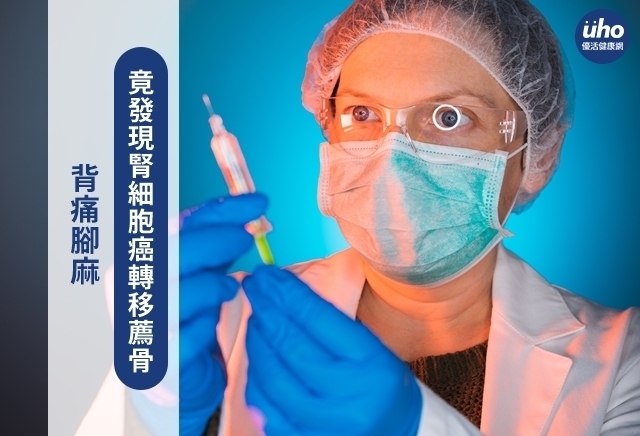 背痛腳麻　竟發現腎細胞癌轉移薦骨